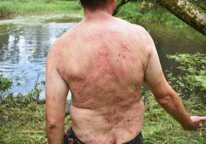 Dar yra sveikų vietų.